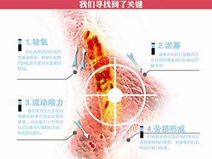 只需一分鐘，肩頸很輕松！——恒怡運(yùn)動(dòng)是有效的